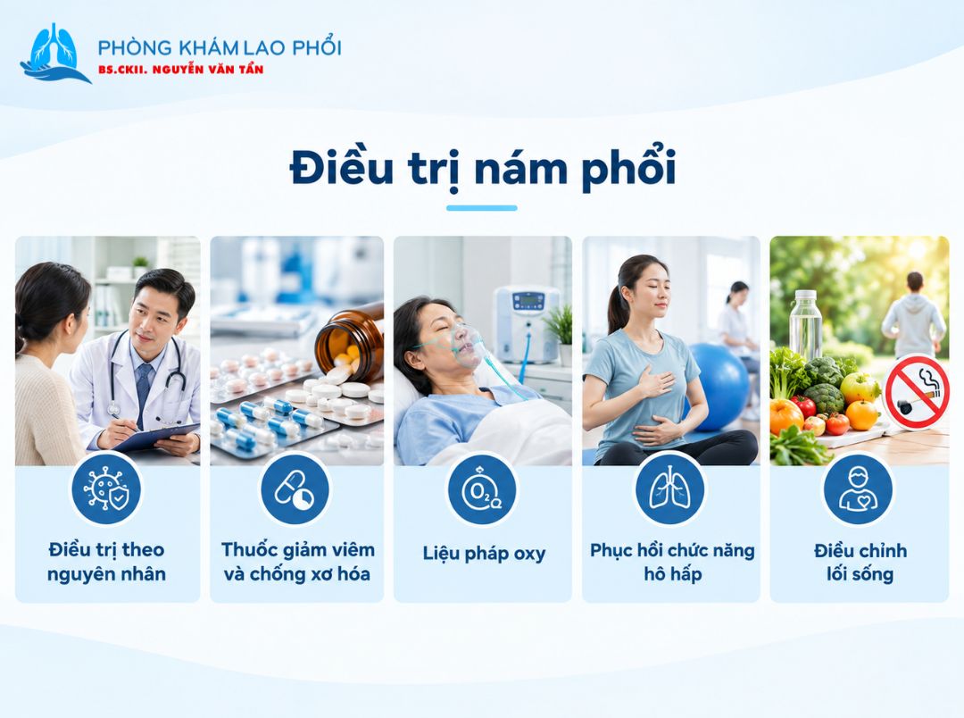 Điều trị nám phổi chủ yếu dựa vào nguyên nhân và mức độ tổn thương 