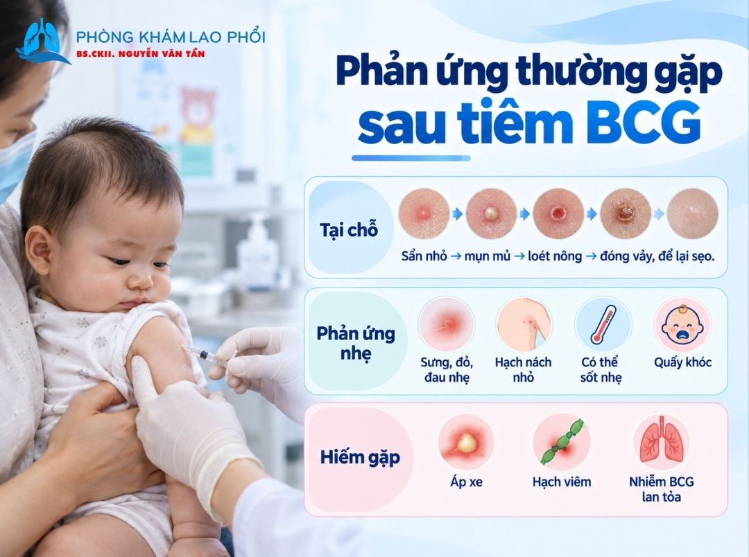 Các phản ứng thường gặp tại vị trí tiêm BCG
