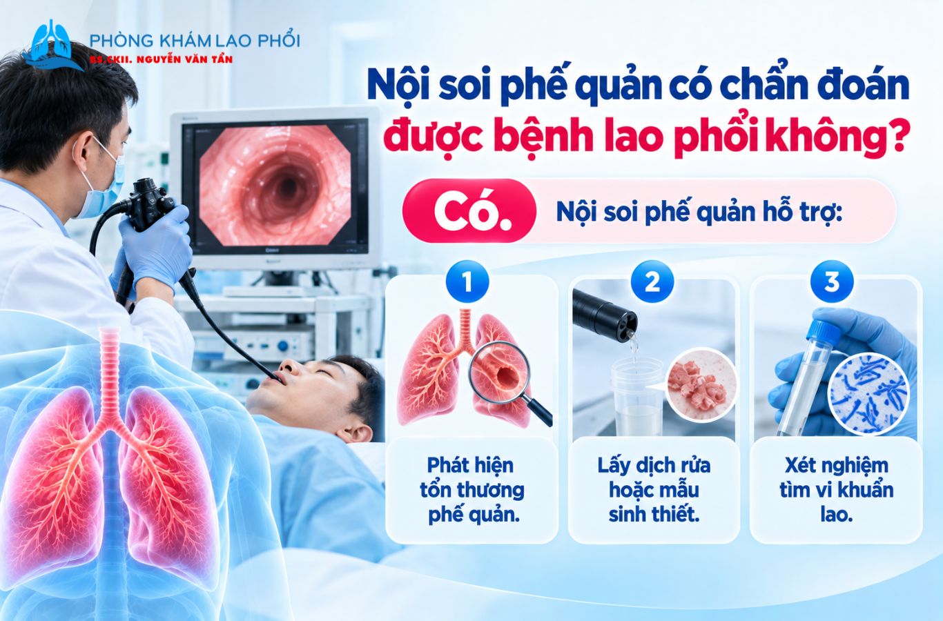Nội soi phế quản có thể giúp chẩn đoán bệnh lao phổi
