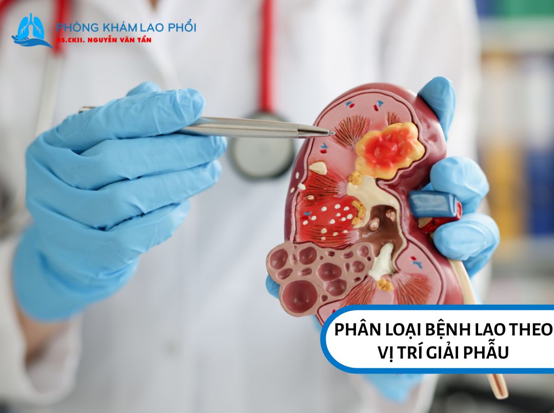 Vị trí giải phẫu là cách phân loại cơ bản và được sử dụng rộng rãi nhất