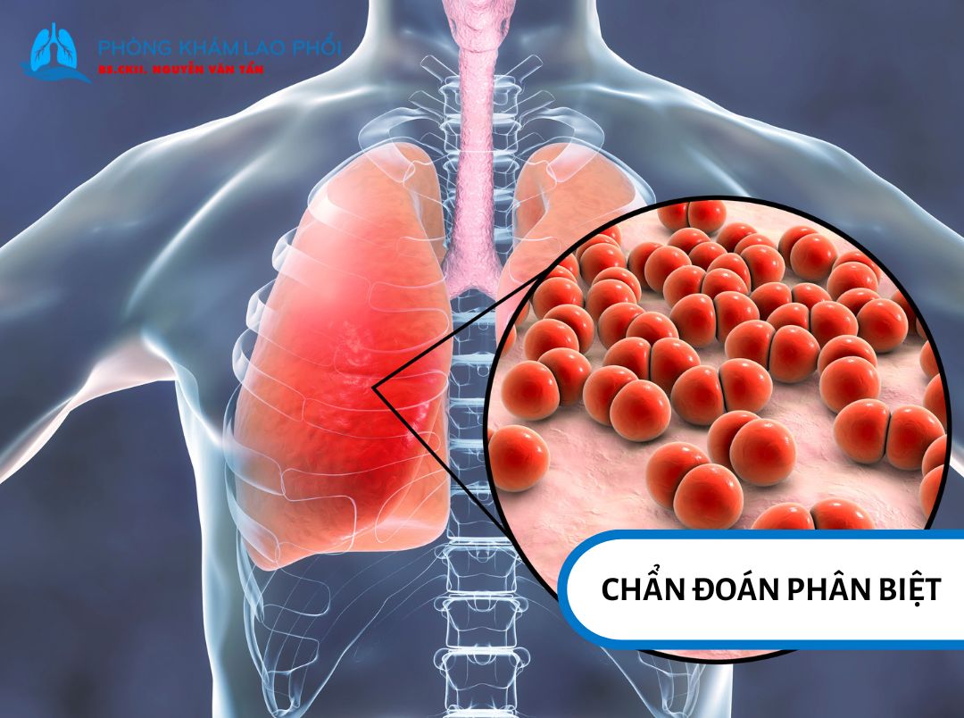 Chẩn đoán phân biệt