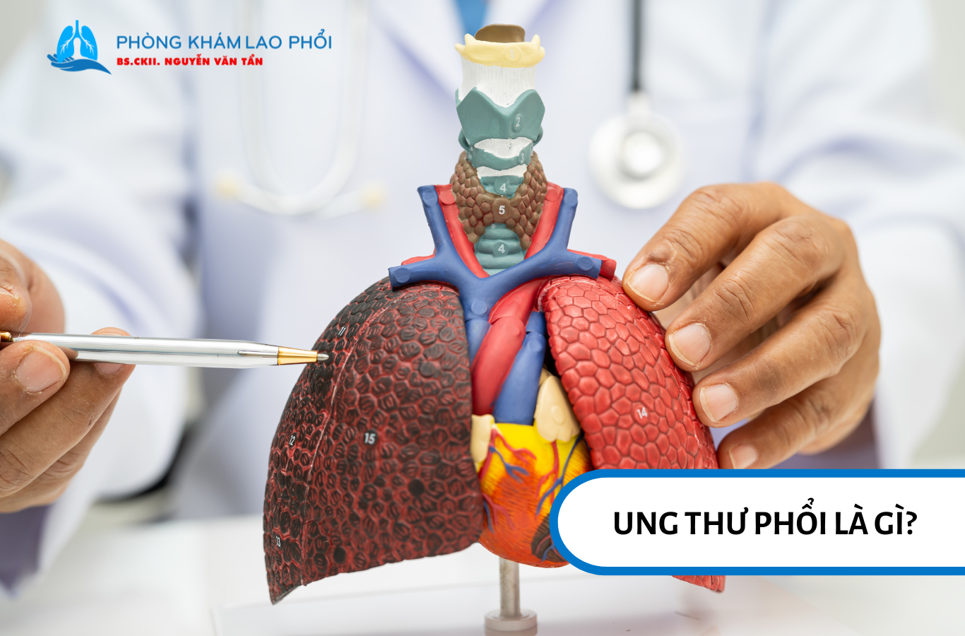 Ung thư phổi là bệnh lý xảy ra khi các tế bào trong phổi phát triển một cách bất thường