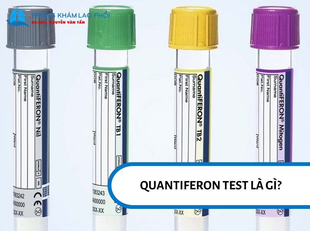 Quantiferon test