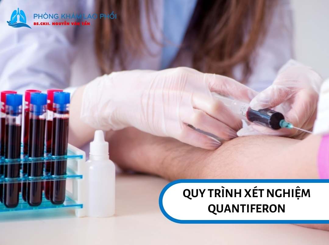 Quy trình xét nghiệm Quantiferon