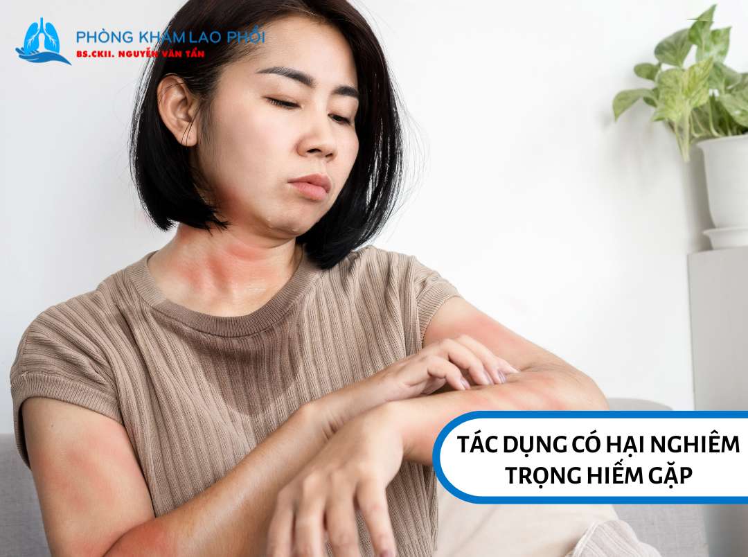 Tác dụng có hại nghiêm trọng hiếm gặp