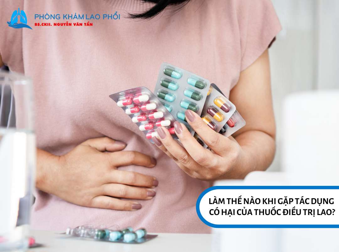 Làm thế nào khi gặp tác dụng có hại của thuốc điều trị lao?