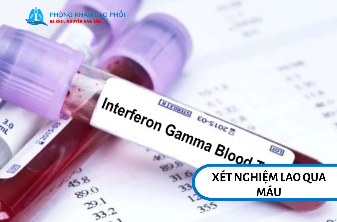 Xét nghiệm lao qua máu