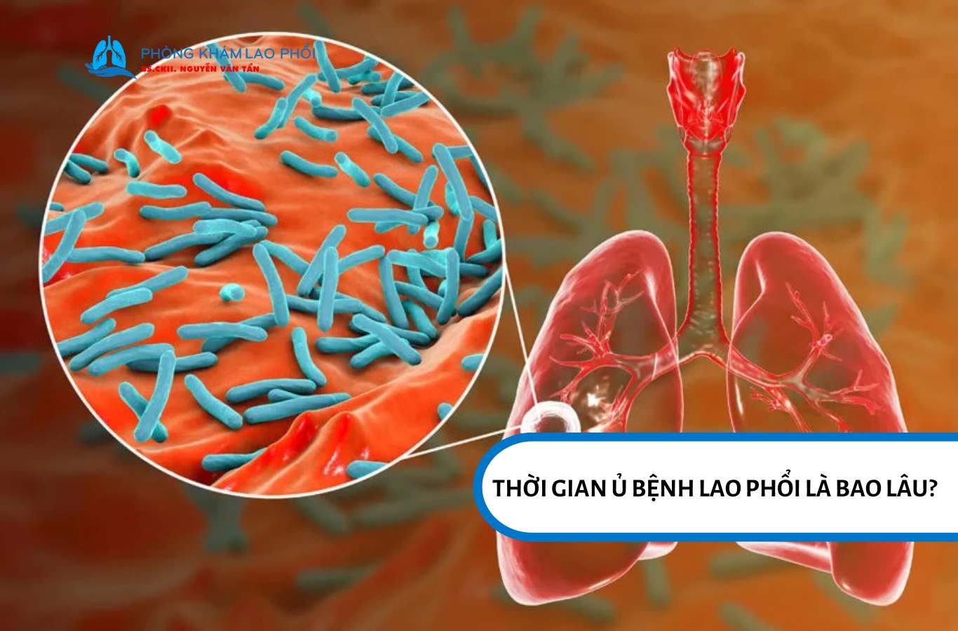 Thời gian ủ bệnh lao phổi là bao lâu? 