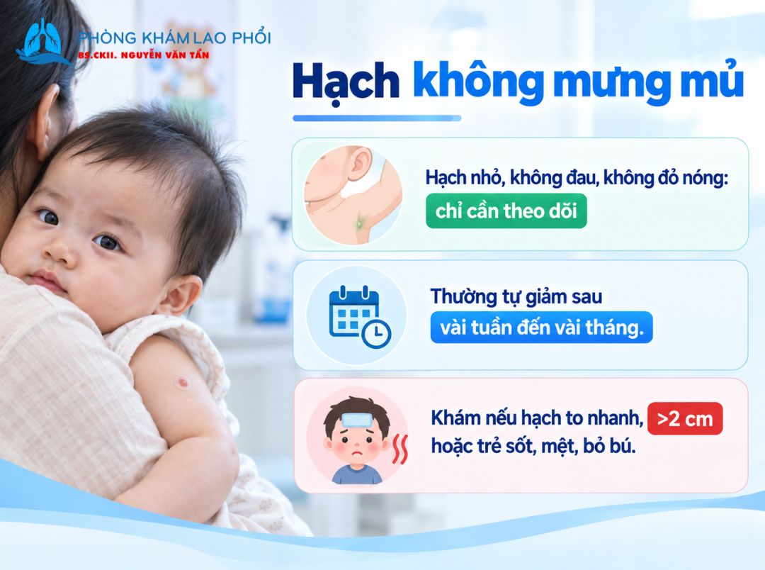 Cách xử trí khi bị nổi hạch ở nách sau tiêm vắc xin lao