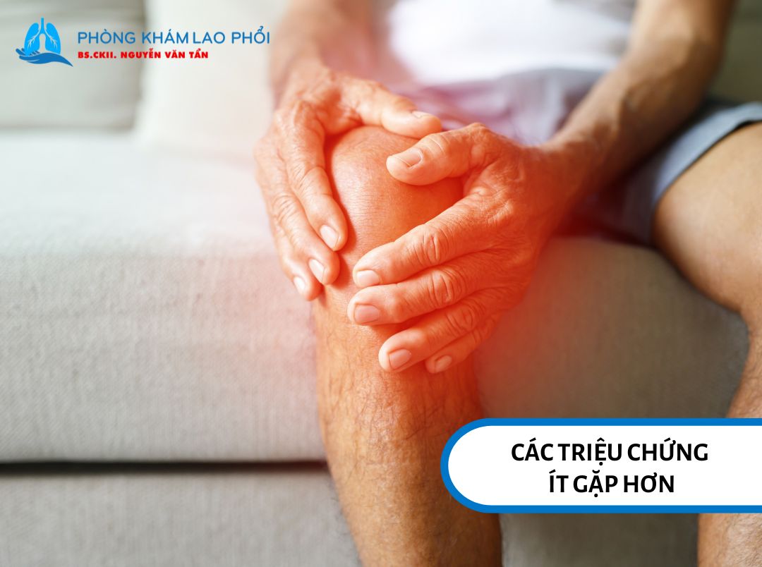 Các triệu chứng ít gặp hơn