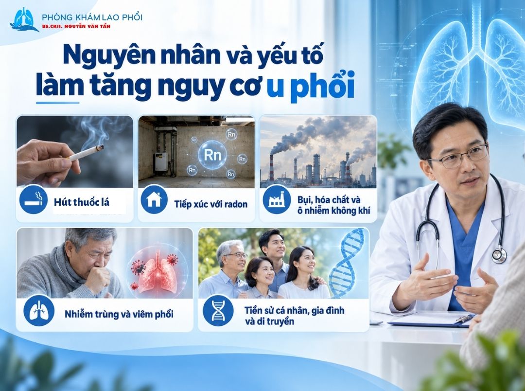 Hút thuốc lá là yếu tố nguy cơ hàng đầu của ung thư phổi