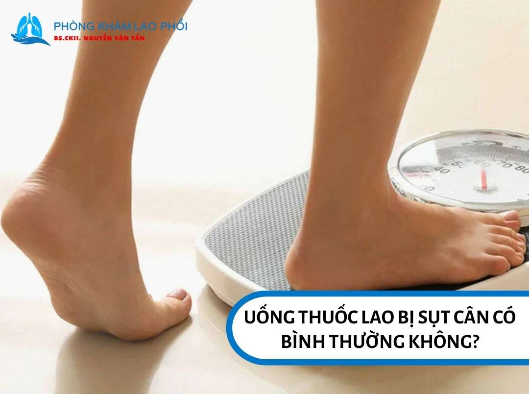 Uống thuốc lao bị sụt cân cần được theo dõi