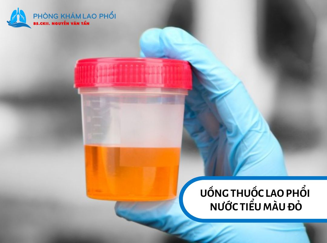 Uống thuốc lao phổi nước tiểu màu đỏ là phản ứng bình thường 