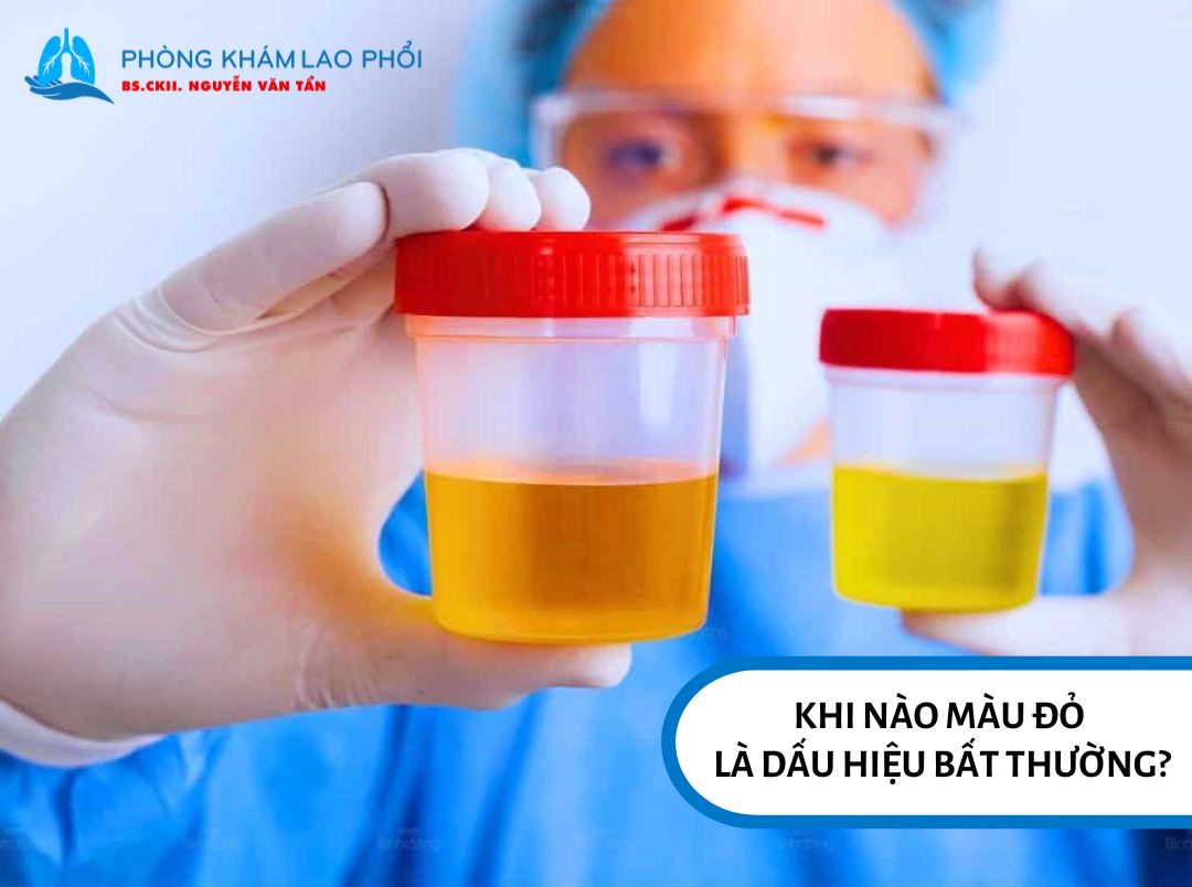 Tiểu ra máu là trường hợp khẩn cấp cần đi khám bác sĩ 