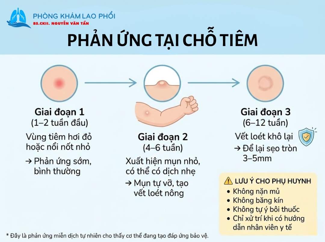 Các giai đoạn phản ứng tại chỗ tiêm