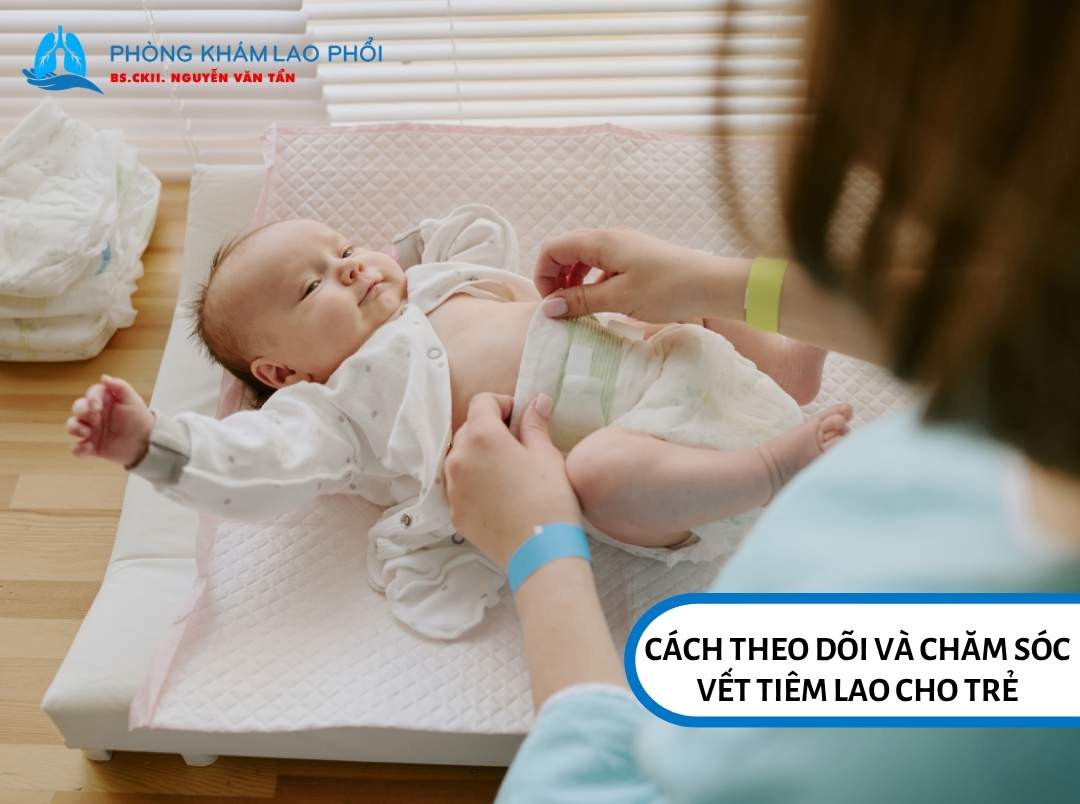 Cách theo dõi và chăm sóc vết tiêm lao cho trẻ