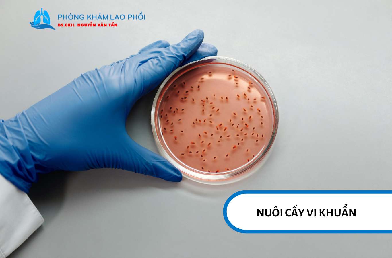 Nuôi cấy vi khuẩn lao