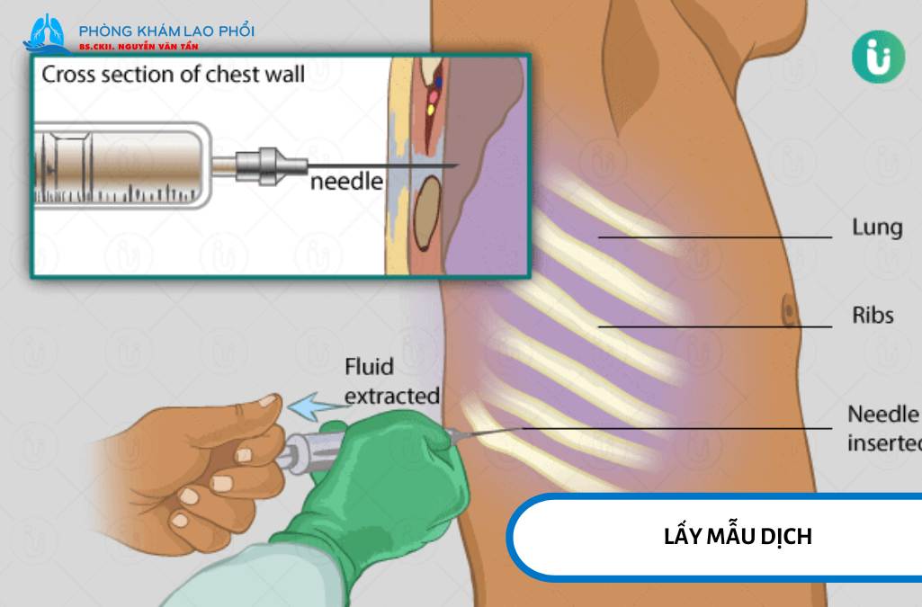 Quy trình xét nghiệm ADA được thực hiện bởi bác sĩ đã qua đào tạo nhằm đảm bảo an toàn