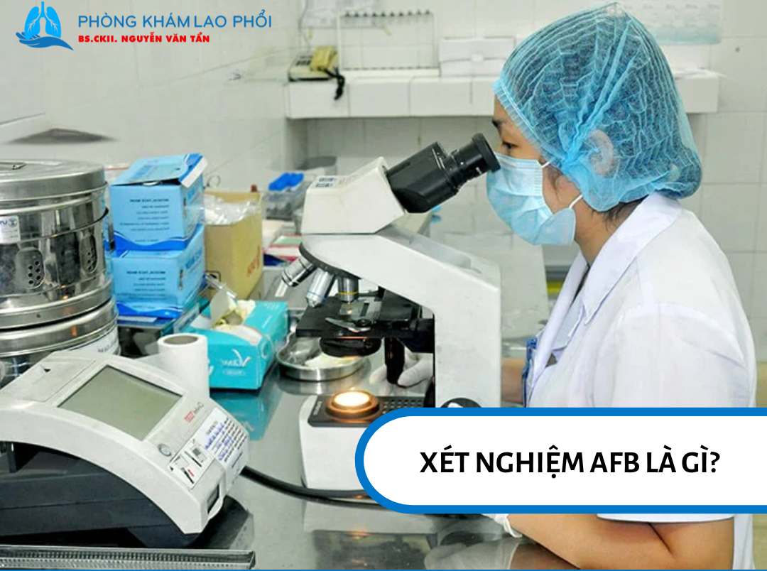Xét nghiệm AFB là kỹ thuật nhuộm đặc biệt để phát hiện vi khuẩn lao dưới kính hiển vi