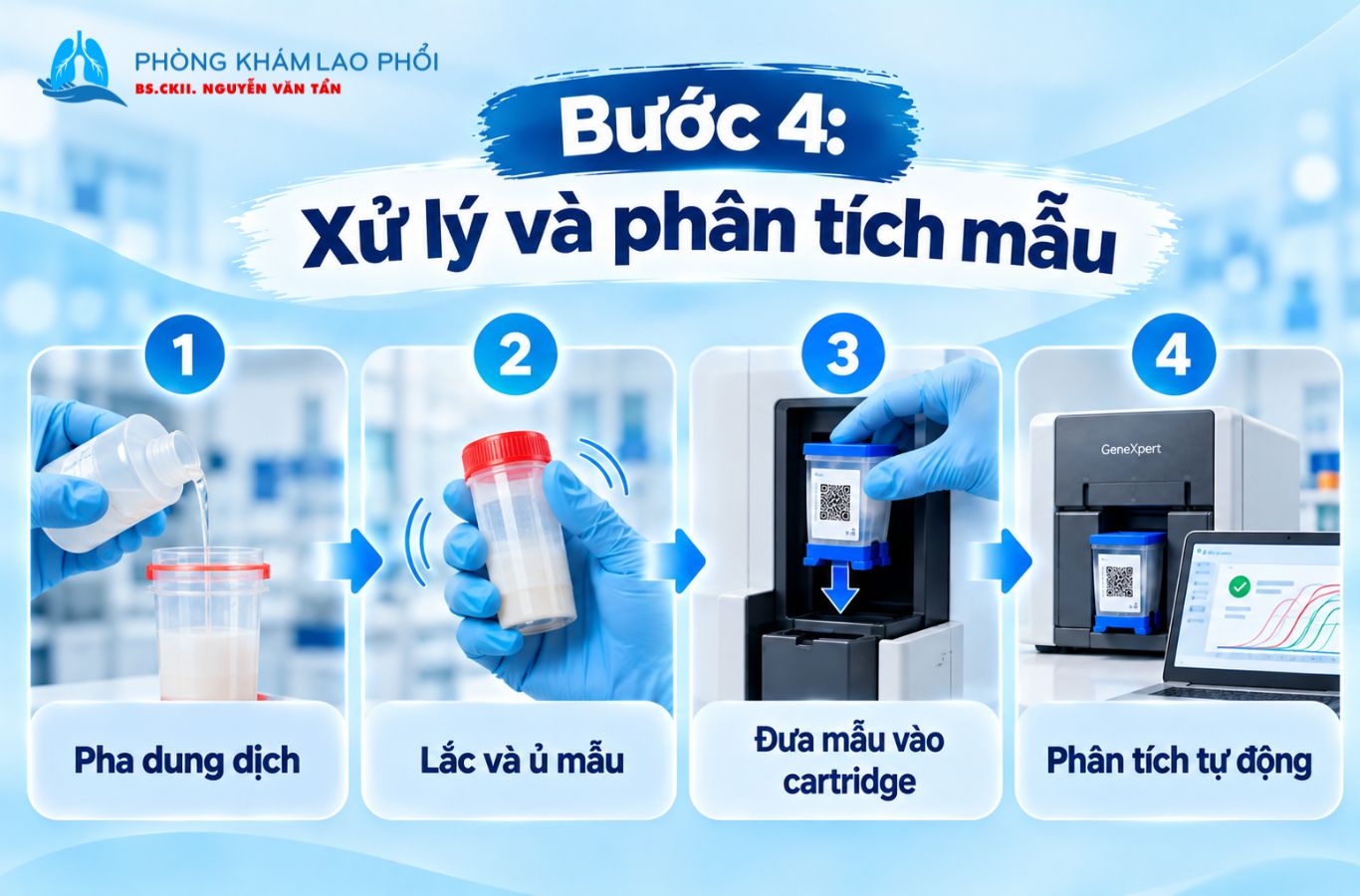 Mẫu được xử lý và phân tích tự động bằng hệ thống GeneXpert.