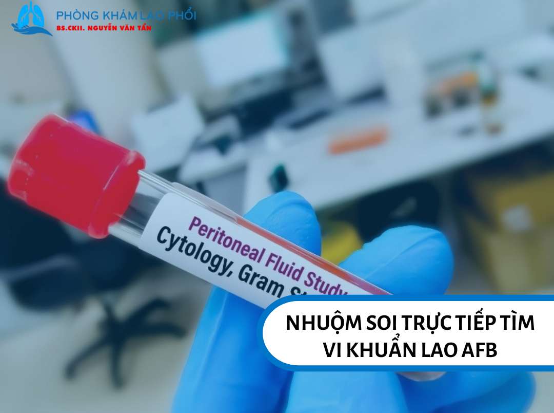 Nhuộm soi trực tiếp tìm AFB để phát hiện lao phổi