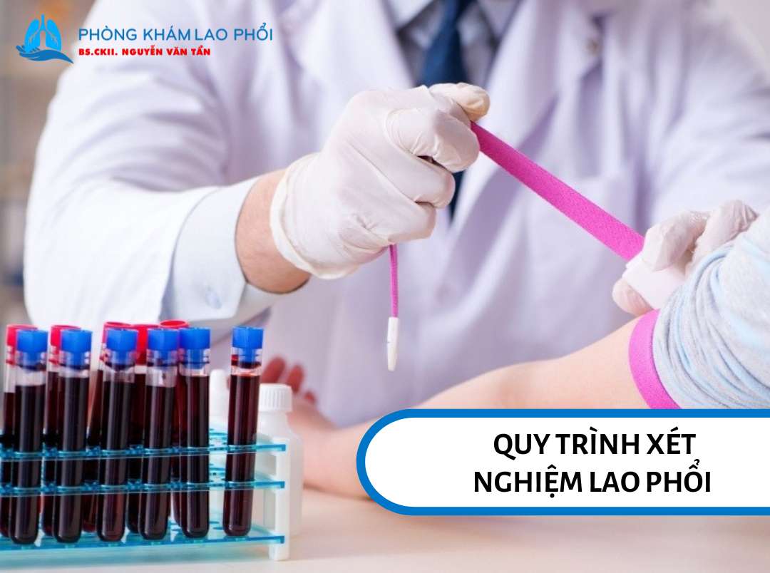 Quy trình xét nghiệm lao phổi