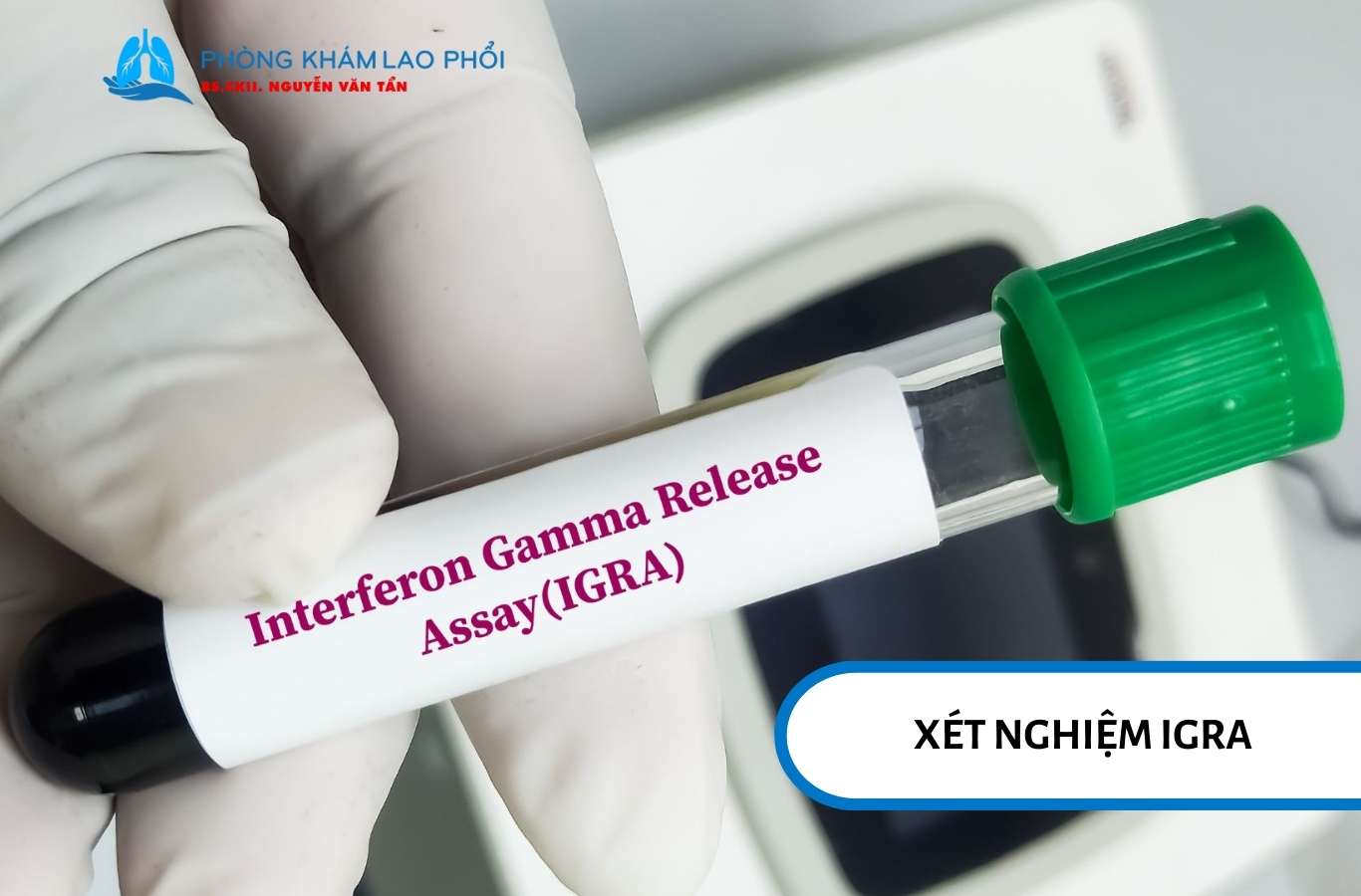 Xét nghiệm IGRA đánh giá nhiễm lao bằng phản ứng miễn dịch tế bào T