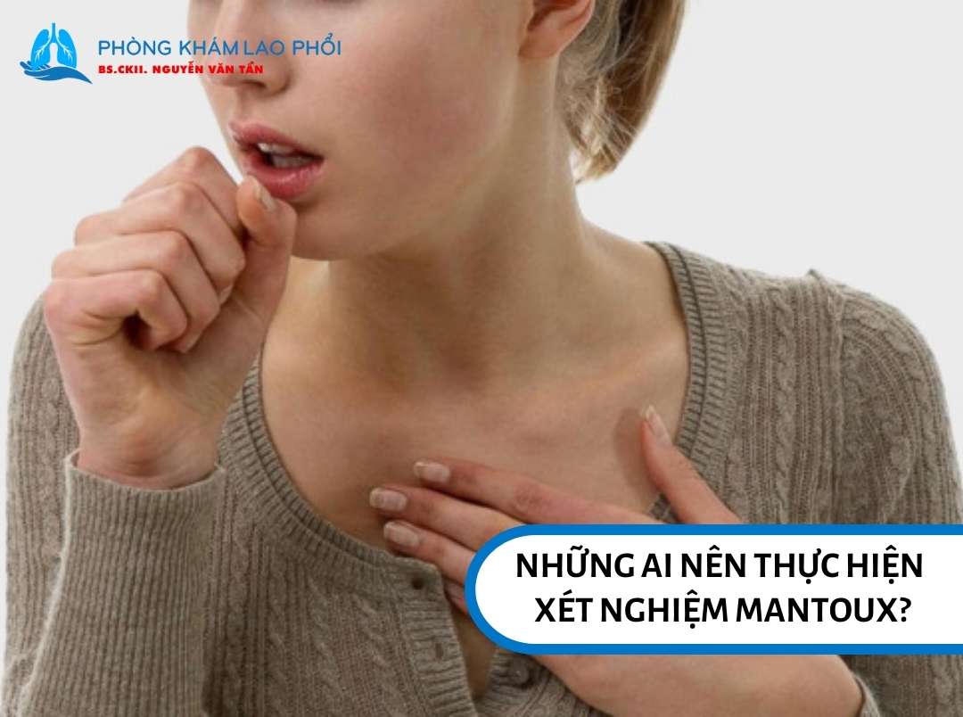 Những ai nên thực hiện xét nghiệm Mantoux