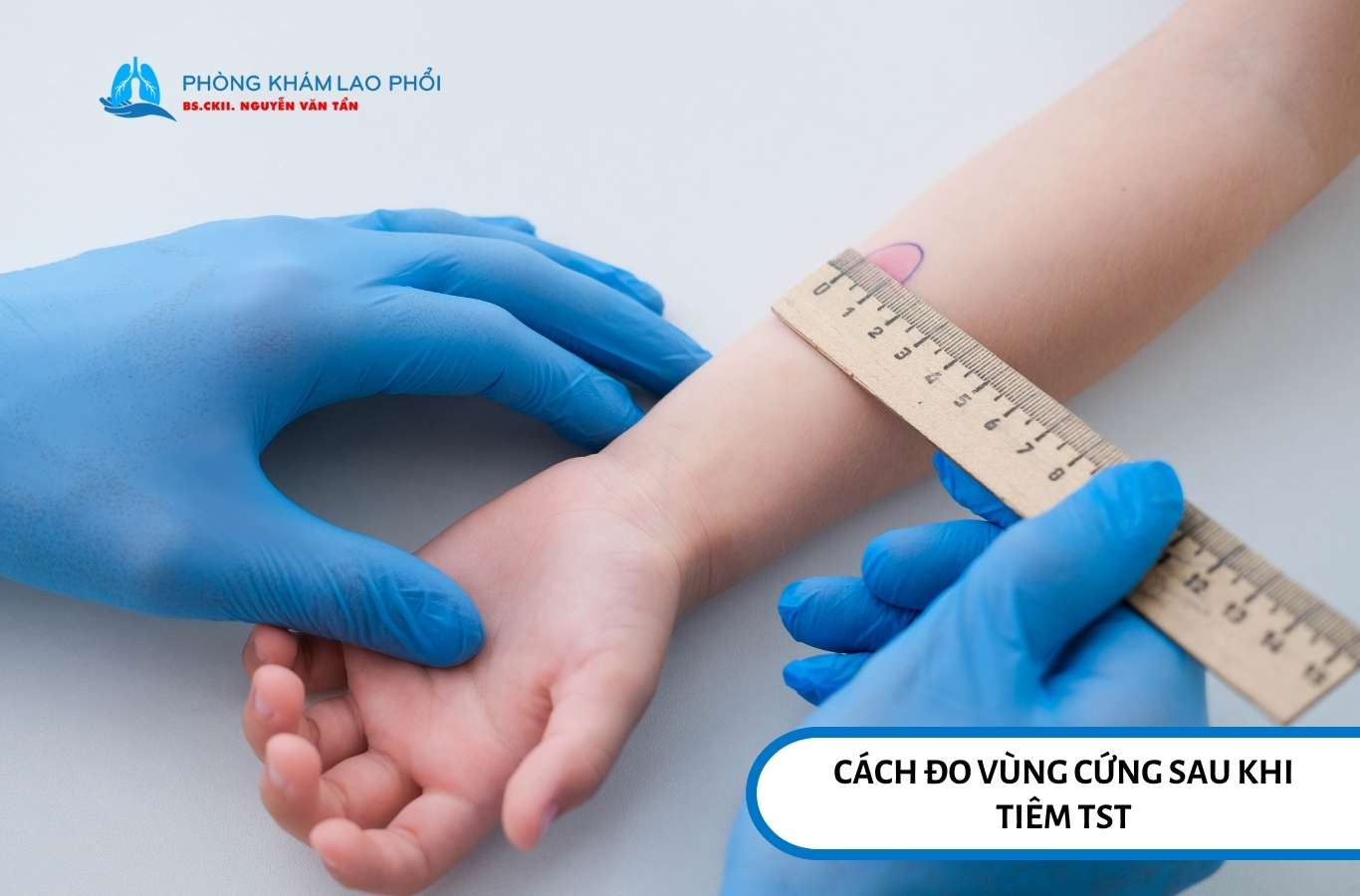 Minh họa cách đo vùng cứng chính xác