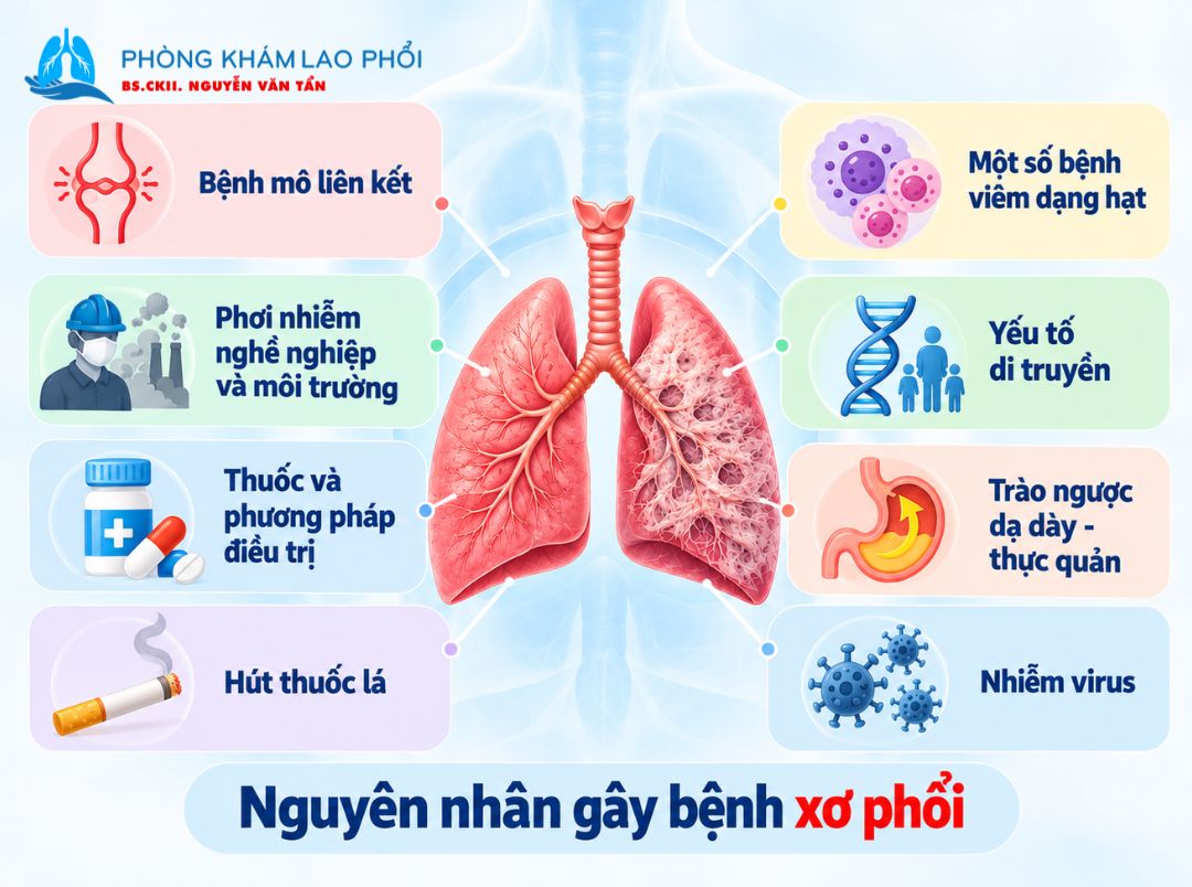 Xơ phổi có thể do bệnh lý, phơi nhiễm, thuốc, hút thuốc và yếu tố di truyền