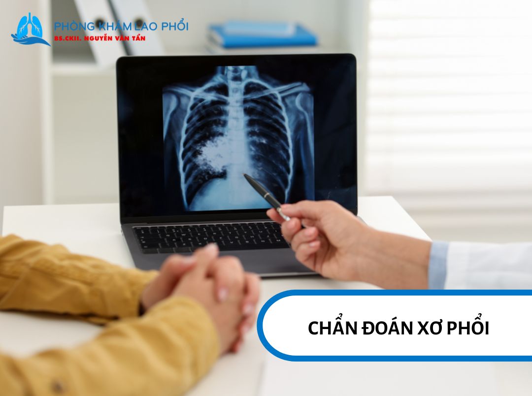 Xơ phổi được chẩn đoán bằng hình ảnh, xét nghiệm và kiểm tra chức năng hô hấp