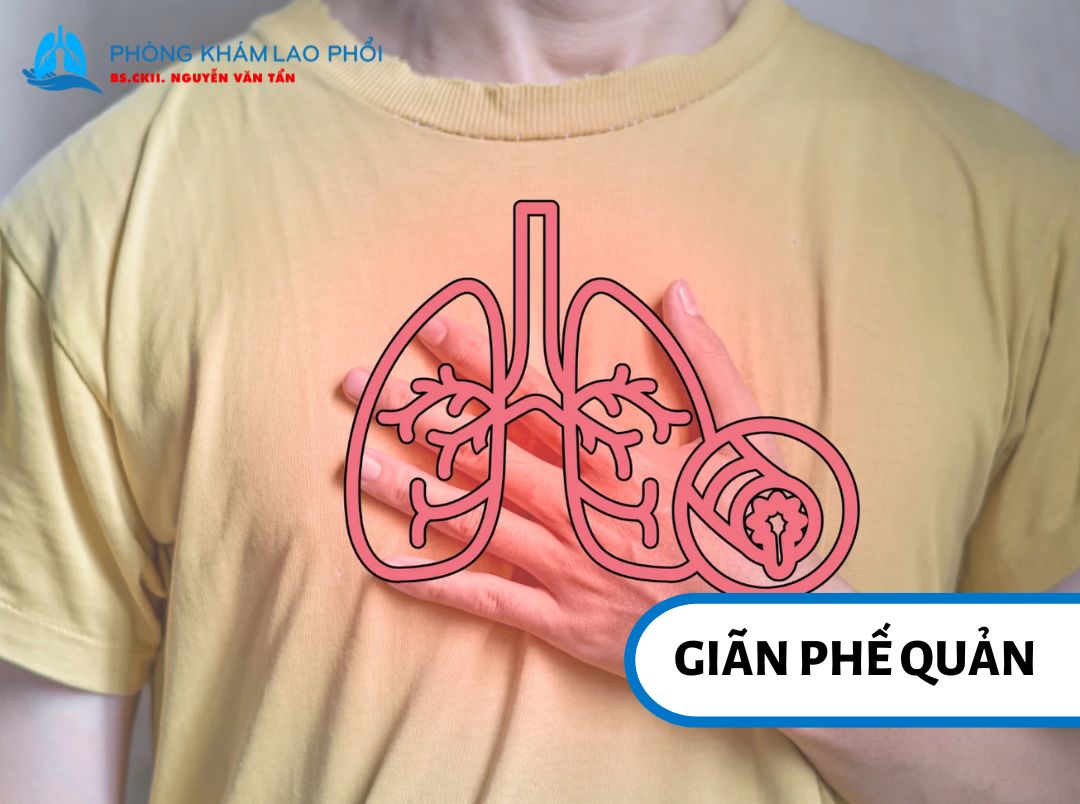 Phế quản giãn rộng bất thường và tích tụ nhiều chất nhầy