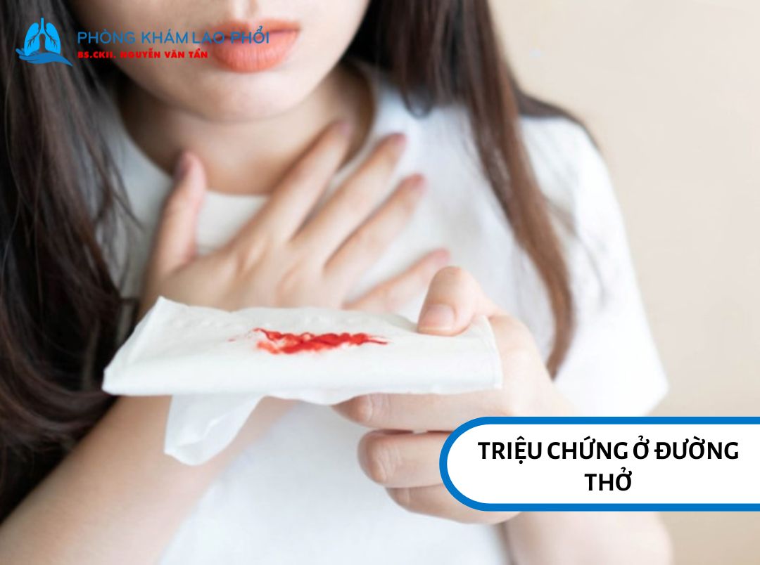 Ho ra máu là biểu hiện của bệnh lao phổi