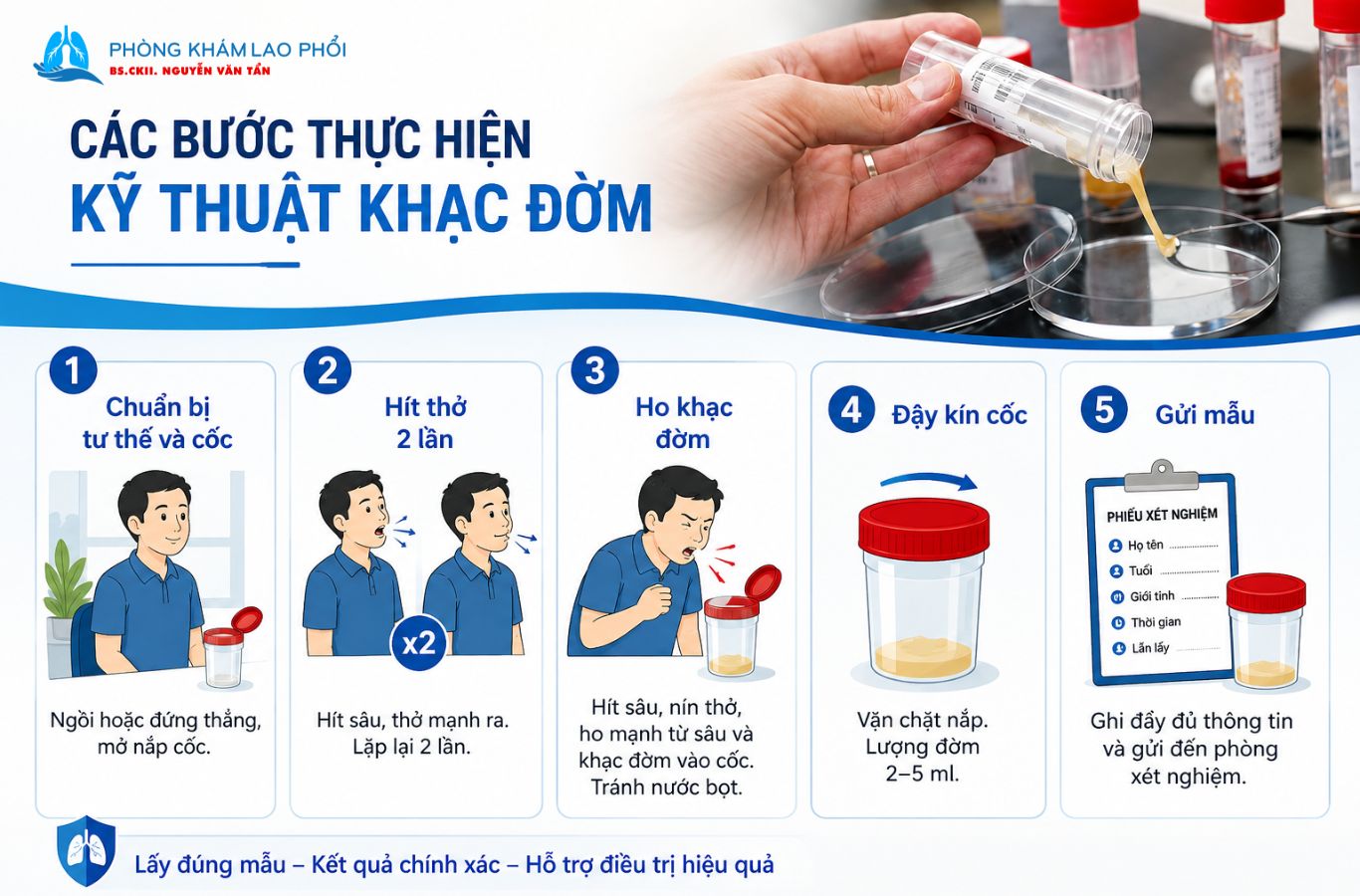Các bước thực hiện kỹ thuật khạc đờm