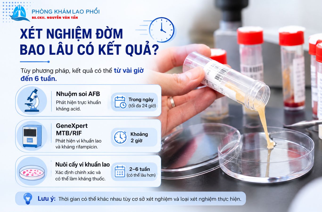 Thời gian trả kết quả xét nghiệm đờm thường từ vài giờ đến 6 tuần