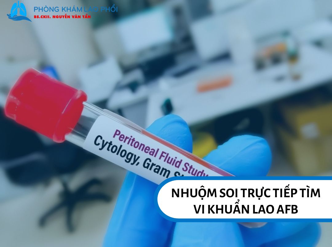 Nhuộm soi trực tiếp tìm AFB để phát hiện lao phổi
