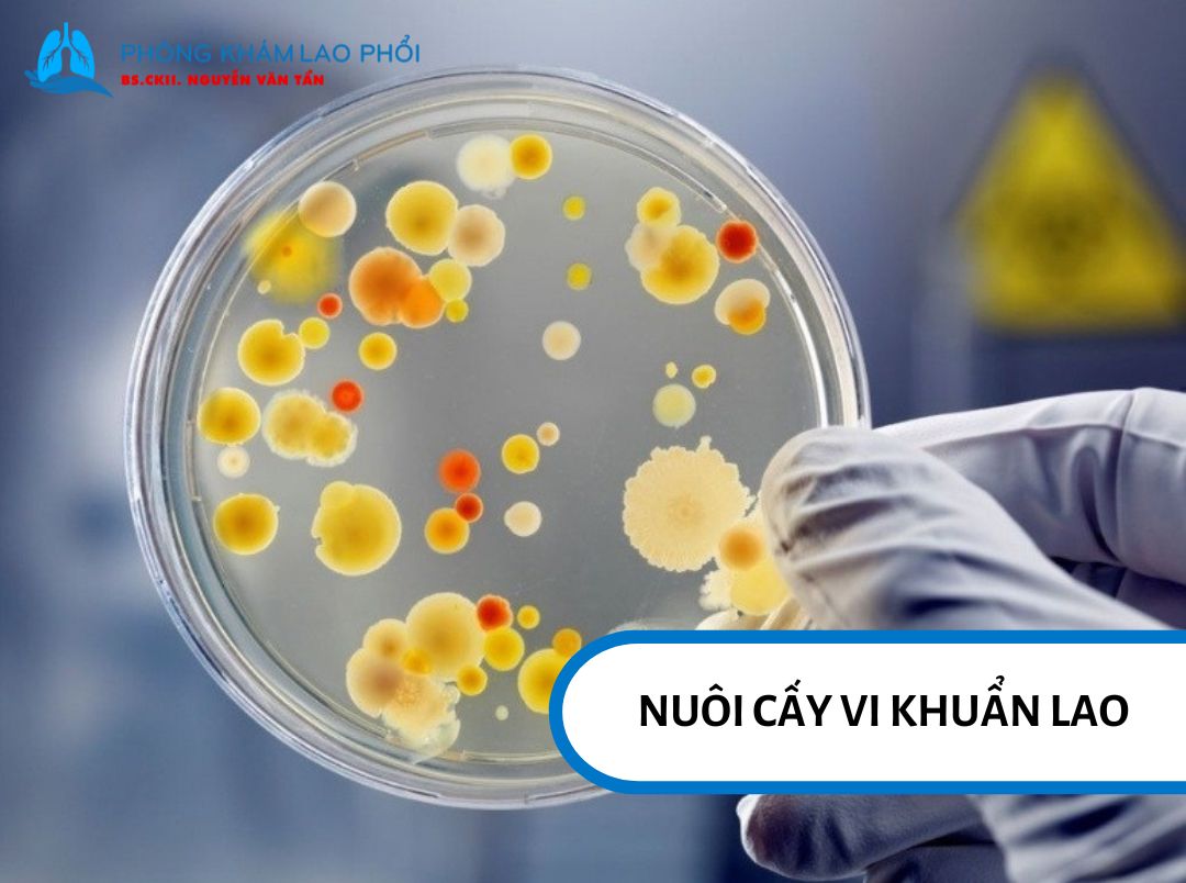 Nuôi cấy có vi khuẩn lao là tiêu chuẩn vàng để chẩn đoán bệnh lao
