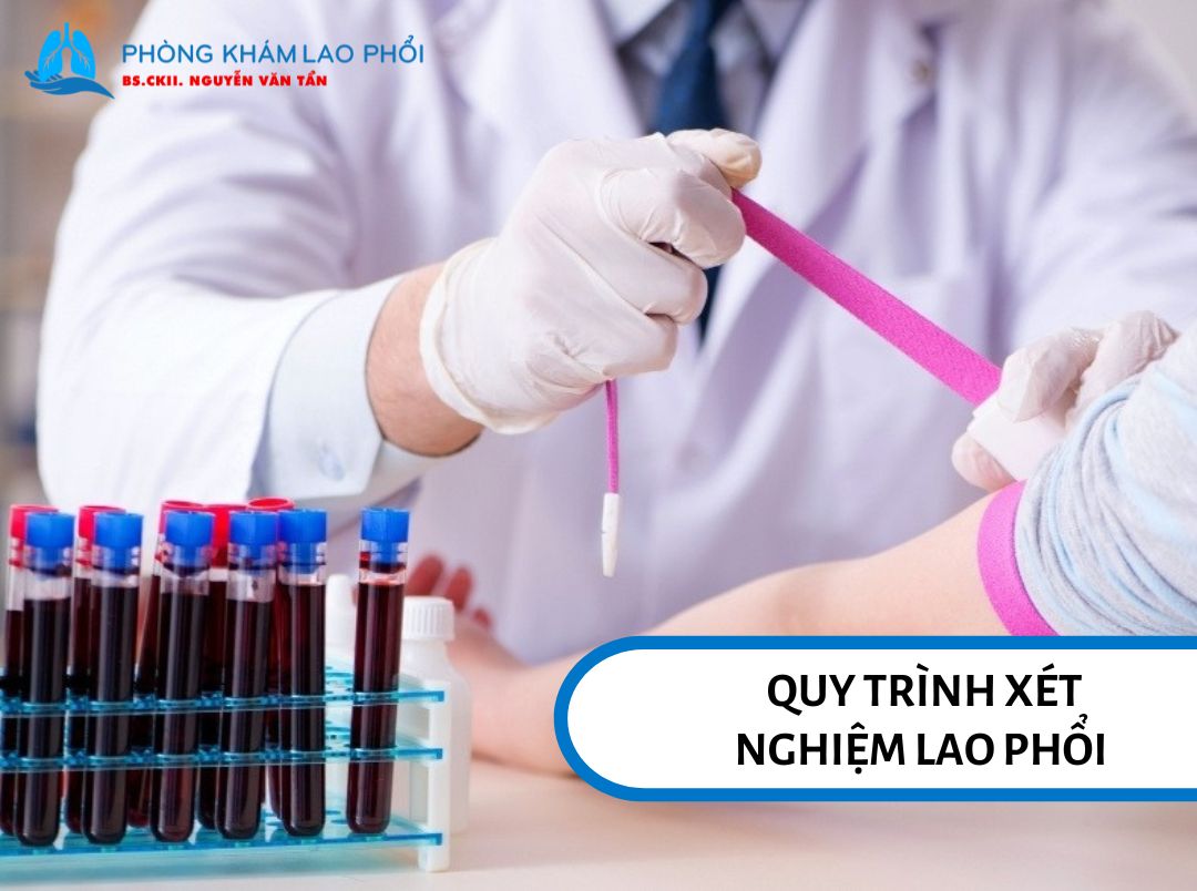 Quy trình xét nghiệm lao phổi